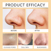 Enzymes Exfoliating Brightening Gel, Gentle Exfoliating Cleansing Gel Deeply Purifies Pores, Removes Blackheads And Brightens Skin by eprolo