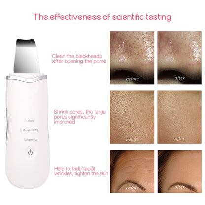 Professional Ultrasonic Facial Skin Scrubber Ion Deep Face Cleaning Peeling Rechargeable Skin Care Device Beauty Instrument 42 by eprolo