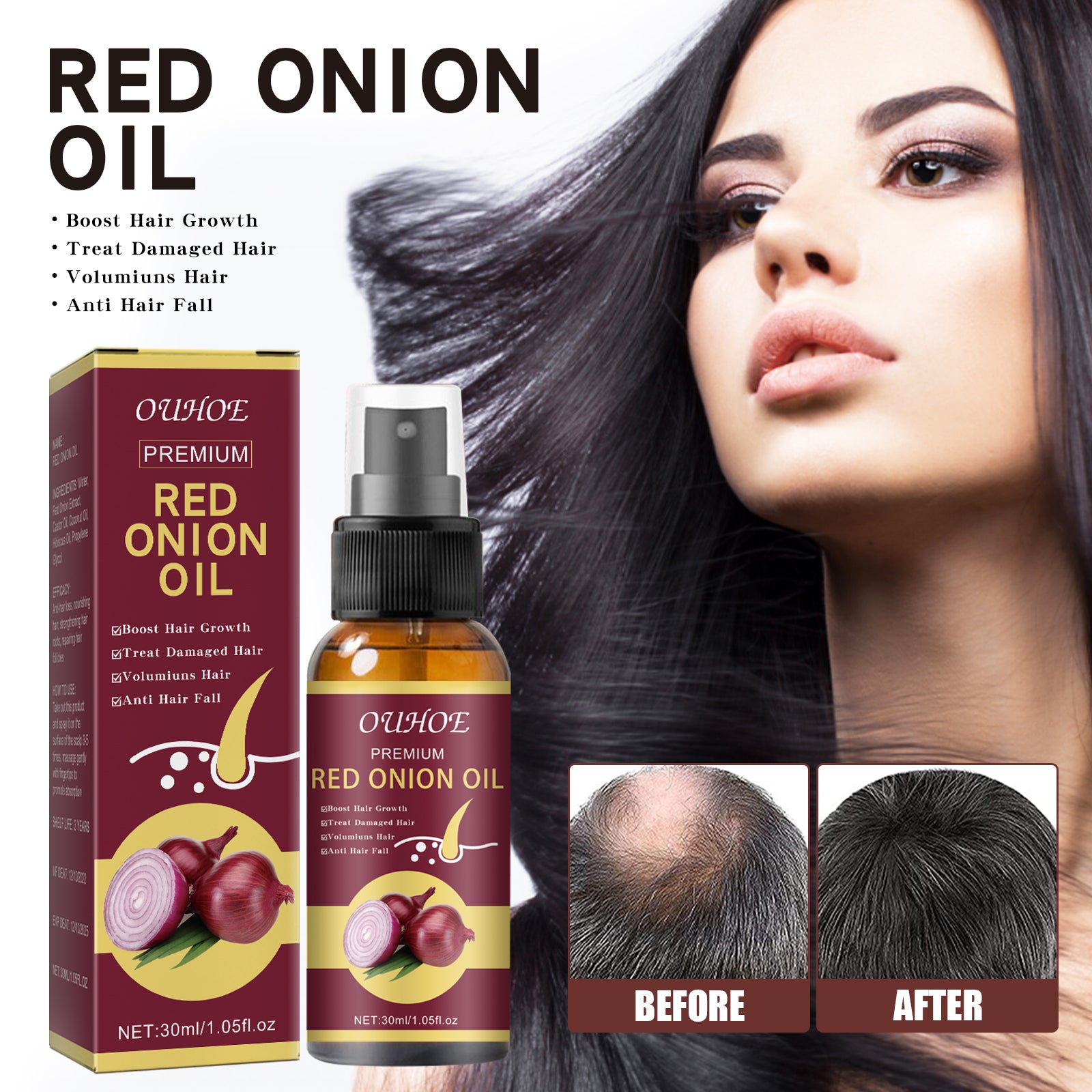 Onion Hair Growth Essential Oil, Strengthens And Hydrates Hair Growth Hair Dense Hair Care Spray by eprolo