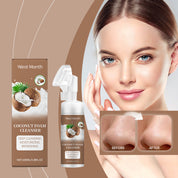 Coconut Foam Gentle Pore Cleanser by eprolo