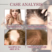 Onion Hair Growth Essential Oil, Strengthens And Hydrates Hair Growth Hair Dense Hair Care Spray by eprolo